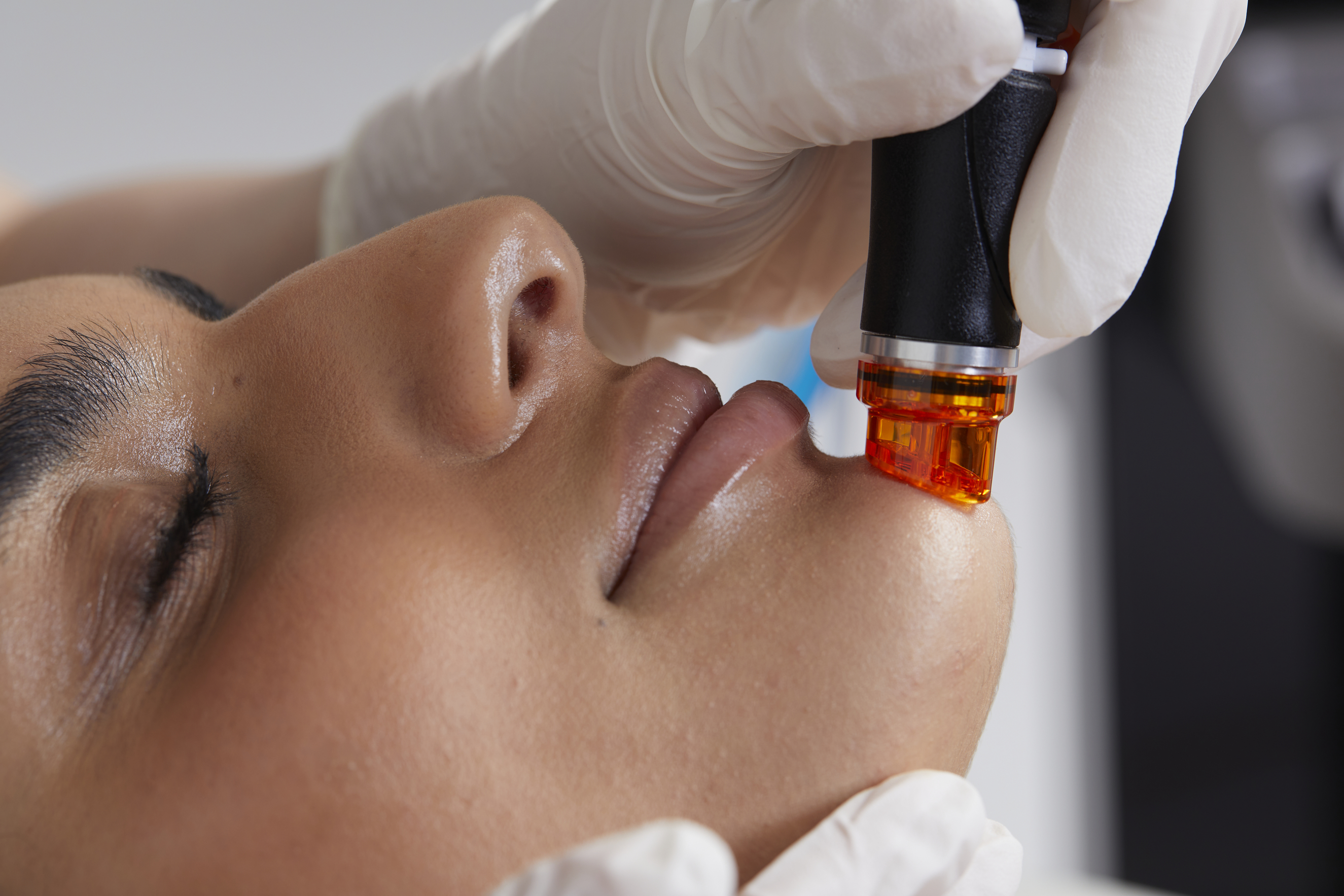 bild-hydrafacial-behandlung