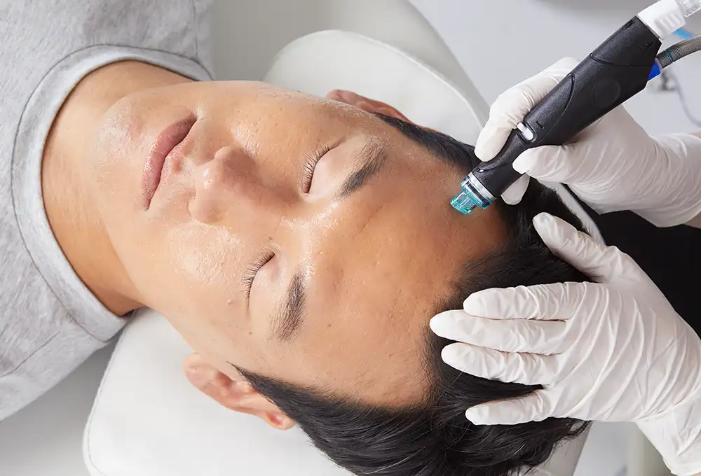 Hydrafacial